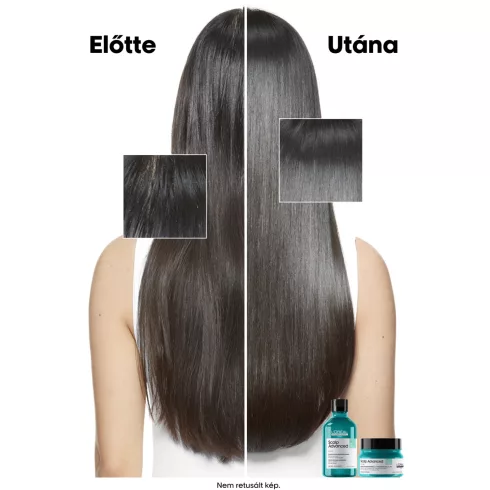 Scalp Advanced tisztító sampon zsíros fejbőrre 300ml