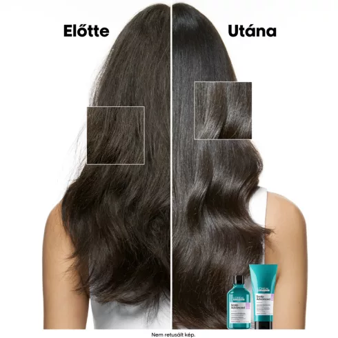 Scalp Advanced Sampon érzékeny és irritált fejbőrre 500ml