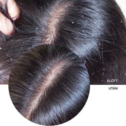 Revox B77 JUST Hyaluronic Acid 2% hidratáló szérum a hajra és a fejbőrre 30ml